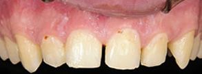 dental images 18052
